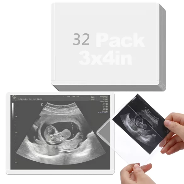 32 db ultrahangfotó-védő tasak, oldalról behelyezhető, 7,6 × 10,2 cm - 32 db, 7,6 × 10,2 cm
