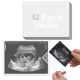 32 db ultrahangfotó-védő tasak, oldalról behelyezhető, 7,6 × 10,2 cm - 32 db, 7,6 × 10,2 cm